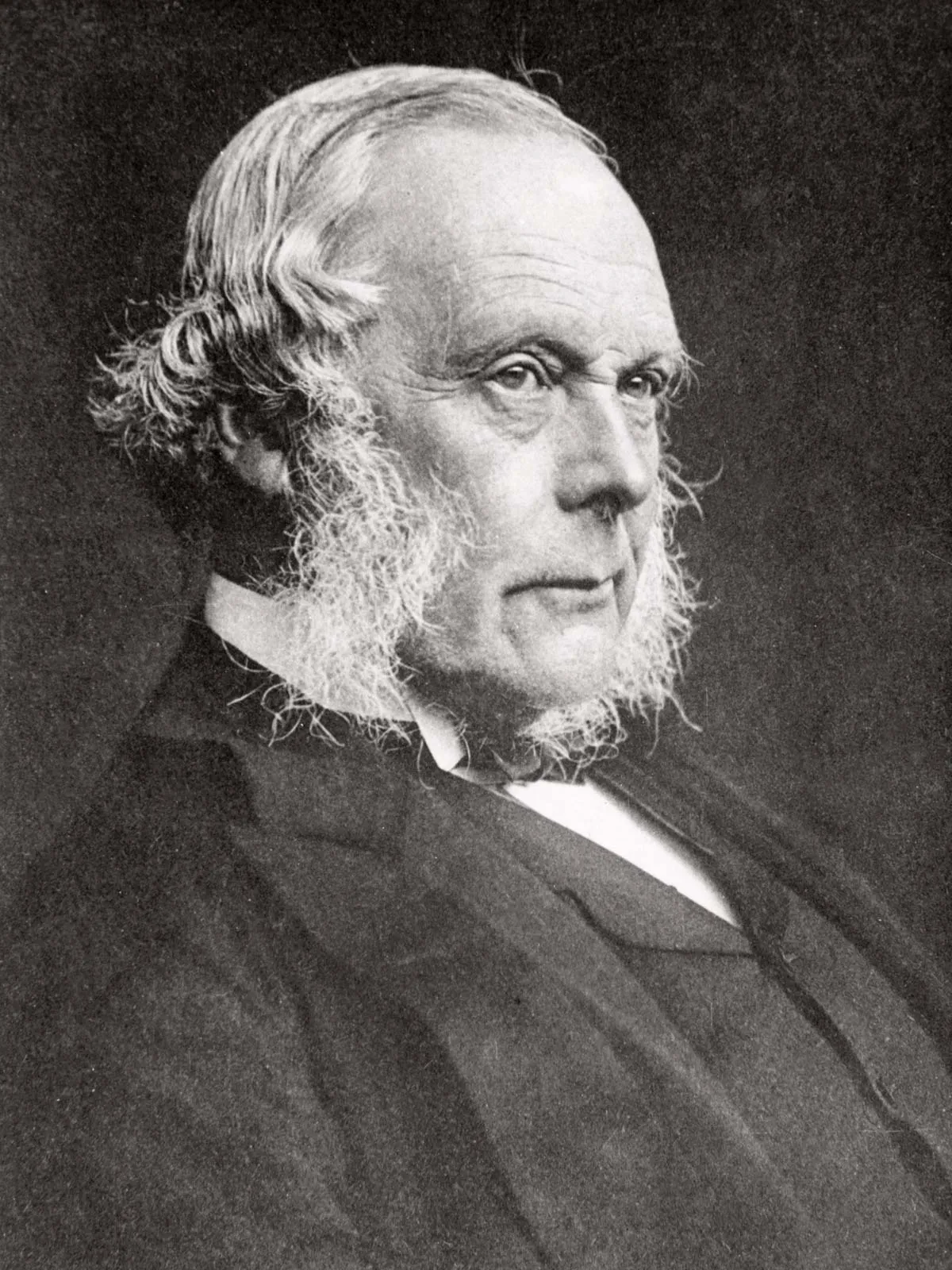 Kisah Joseph Lister, 1st Baron Lister (1827-1912): Bapak Antiseptik