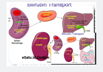 4 Penyebab Naiknya Bilirubin Pada Tubuh Manusia Biology Diagrams